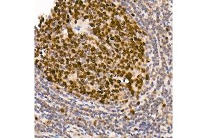 Immunohistochemistry of paraffin-embedded human tonsil using [KO Validated] DNMT1 Rabbit mAb (ABIN7266808) at dilution of 1:100 (40x lens). (DNMT1 antibody)