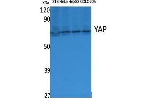 Western Blot (WB) analysis of specific cells using YAP Polyclonal Antibody.