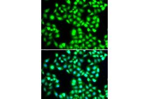 Immunofluorescence analysis of A-549 cells using YTHDC1 antibody. (YTHDC1 antibody  (AA 260-500))