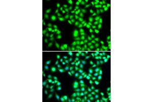 Immunofluorescence analysis of A-549 cells using YTHDC1 antibody. (YTHDC1 antibody  (AA 260-500))