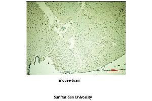 Immunohistochemistry (IHC) analysis:Please contact us for more details. (TH antibody  (Tyr161))