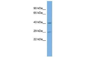 NAT15 antibody used at 1 ug/ml to detect target protein. (NAT15 antibody)