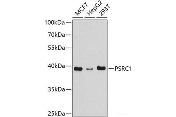 PSRC1 抗体