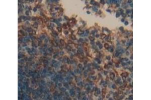 #VALUE! (CD72 antibody  (AA 143-345))