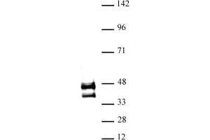 JunD antibody (pAb) tested by Western blot. (JunD antibody  (N-Term))