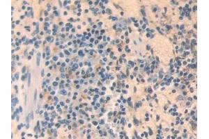Detection of MX1 in Mouse Spleen Tissue using Polyclonal Antibody to Myxovirus Resistance 1 (MX1) (MX1 antibody  (AA 43-308))