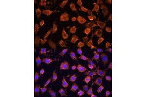 Immunofluorescence analysis of L929 cells using RPL11 antibody (ABIN6129101, ABIN6147106, ABIN6147108 and ABIN6222040) at dilution of 1:100. (RPL11 antibody  (AA 1-177))
