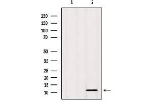 Western blot analysis of extracts from Mouse spleen, using CSTA Antibody. (CSTA antibody  (C-Term))