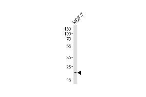 Western blot analysis of lysate from MCF-7 cell line, using NOS1 Antibody (Center) 10269c. (NOS1AP antibody  (AA 437-466))