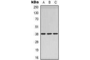 Western blot analysis of CER1 expression in MCF7 (A), rat heart (B), rat brain (C) whole cell lysates.