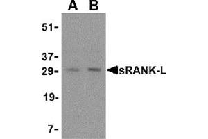 Western Blotting (WB) image for anti-Tumor Necrosis Factor (Ligand) Superfamily, Member 11 (TNFSF11) (Middle Region) antibody (ABIN1031107) (RANKL antibody  (Middle Region))