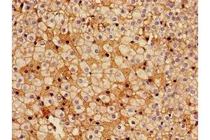 Immunohistochemistry of paraffin-embedded human adrenal gland tissue using ABIN7142312 at dilution of 1:100 (HSD17B7 antibody  (AA 128-198))