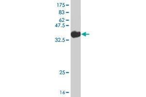 Western Blot detection against Immunogen (36. (STRADB antibody  (AA 1-95))