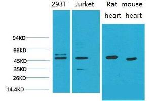 Western Blot (WB) analysis of 1)293T, 2)Jurkat, 3)Rat Heart Tissue, 4)Mouse Heart Tissue with Smad3 Mouse Monoclonal Antibody diluted at 1:2000.