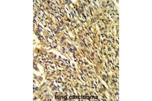 Immunohistochemistry (IHC) image for anti-Potassium Inwardly-Rectifying Channel, Subfamily J, Member 2 (KCNJ2) antibody (ABIN3002884) (KCNJ2 antibody)