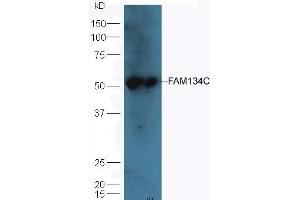 Mouse liver lysates probed with Rabbit Anti-FAM134C Polyclonal Antibody (ABIN872917) at 1:300 overnight in 4 °C. (FAM134C antibody  (AA 76-180))