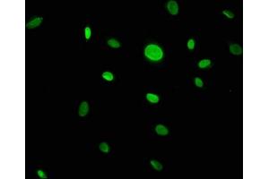 Immunofluorescence staining of U251 cells with ABIN7146450 at 1:133, counter-stained with DAPI. (CACYBP antibody  (AA 2-228))