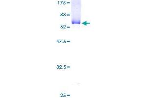 SDS-PAGE (SDS) image for Abhydrolase Domain Containing 5 (ABHD5) (AA 1-349) protein (GST tag) (ABIN1305519) (ABHD5 Protein (AA 1-349) (GST tag))