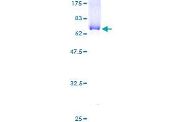 ABHD5 Protein (AA 1-349) (GST tag)