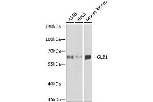 Western blot analysis of extracts of various cell lines using GLB1 Polyclonal Antibody at dilution of 1:1000. (GLB1 antibody)