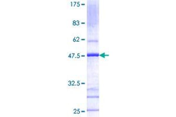 UBE2B Protein (AA 1-152) (GST tag)