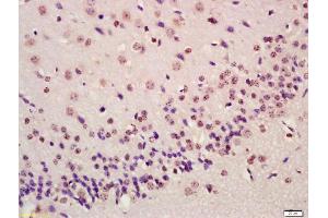 Formalin-fixed and paraffin embedded mouse brain labeled with Anti-ATF4/CREB-2 Polyclonal Antibody, Unconjugated (ABIN687862) at 1:200 followed by conjugation to the secondary antibody and DAB staining (ATF4 antibody  (AA 251-351))