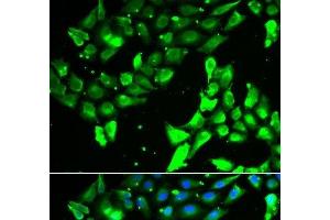 Immunofluorescence analysis of A549 cells using KIF2B Polyclonal Antibody (KIF2B antibody)