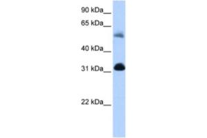 Western Blotting (WB) image for anti-3-Oxoacid CoA Transferase 1 (OXCT1) antibody (ABIN2463187) (OXCT1 antibody)