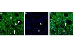 Expression of Choline transporter in rat striatum - Immunohistochemical staining of rat frozen brain sections using Anti-Choline Transporter (SLC5A7) (extracellular) Antibody (ABIN7043267 and ABIN7044218) (1:200). (ChT antibody  (4th Extracellular Loop))