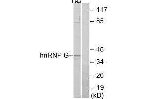 Western blot analysis of extracts from HeLa cells, using hnRNP G antibody.