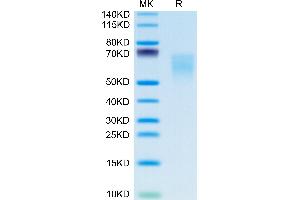 CD86 Protein (CD86) (His-Avi Tag)