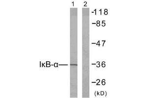 Western blot analysis of extracts from 293 cells untreated or treated with TNF-α (20ng/ml, 30min), using IκB-α (Ab-42) antibody (E021176). (NFKBIA antibody)