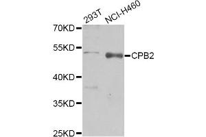 Western blot analysis of extracts of various cell lines, using CPB2 Antibody (ABIN1876835) at 1:1000 dilution. (CPB2 antibody)