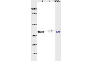 Lane 1: rat brain lysates Lane 2: rat kidney lysates probed with Anti Inhibin Alpha Polyclonal Antibody, Unconjugated (ABIN736656) at 1:200 in 4 °C. (Inhibin alpha antibody  (AA 301-366))