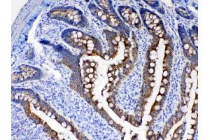 IHC analysis of Cytokeratin 8 using anti- Cytokeratin 8 antibody . (KRT8 antibody  (AA 107-325))