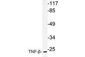Western blot analysis of TNF-β antibody in extracts from COS-7cells. (LTA antibody)