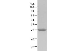 Western Blotting (WB) image for Fucosidase, alpha-L- 1, Tissue (FUCA1) (AA 269-466) protein (His tag) (ABIN7123011) (FUCA1 Protein (AA 269-466) (His tag))