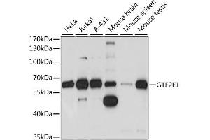 Western blot analysis of extracts of various cell lines, using GTF2E1 antibody (ABIN6292967) at 1:1000 dilution. (GTF2E1 antibody)