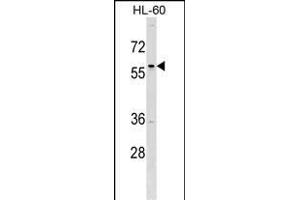 TFD Antibody (C-term) (ABIN1537108 and ABIN2849445) western blot analysis in HL-60 cell line lysates (35 μg/lane). (TFAP2D antibody  (C-Term))
