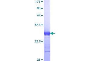 POLE2 Protein (AA 1-100) (GST tag)