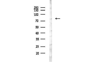 Western blot analysis of lysates from EC304 cells(heat-shock,45 min treatment), using CLIP4 Antibody at 1/1000 dilution.