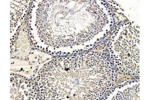 ABIN7096575 and ABIN7100639 at 1/100 staining rat testis tissue by IHC-P.