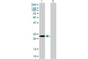Western Blot analysis of PTTG1IP expression in transfected 293T cell line by PTTG1IP monoclonal antibody (M04), clone 4C11. (PTTG1IP antibody  (AA 1-180))