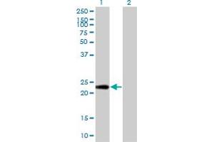 Western Blot analysis of PTTG1IP expression in transfected 293T cell line by PTTG1IP monoclonal antibody (M04), clone 4C11.