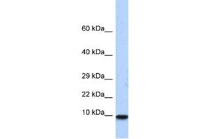 WB Suggested Anti-PCBD1 Antibody Titration:  0. (PCBD1 antibody  (N-Term))