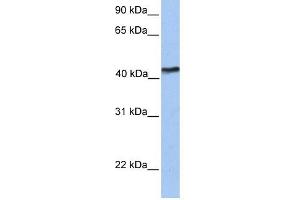 TMEM149 antibody used at 1 ug/ml to detect target protein. (IGF-like family receptor 1 (IGFLR1) (N-Term) antibody)
