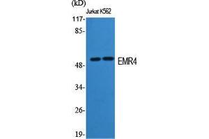 Western Blot (WB) analysis of specific cells using EMR4 Polyclonal Antibody. (EMR4 antibody  (Internal Region))