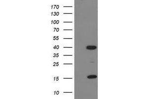 HEK293T cells were transfected with the pCMV6-ENTRY control (Left lane) or pCMV6-ENTRY PDLIM2 (Right lane) cDNA for 48 hrs and lysed. (PDLIM2 antibody)