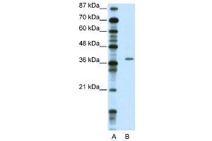 WB Suggested Anti-ZNF444  Antibody Titration: 2. (ZNF444 antibody  (C-Term))
