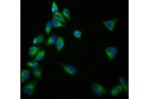 Immunofluorescence staining of Hela cells with ABIN7153359 at 1:166, counter-stained with DAPI. (Gpr98 antibody  (AA 6155-6306))